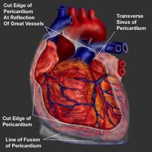 Pericarditis