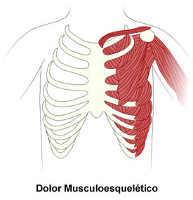 Muskuloskeletal Pain