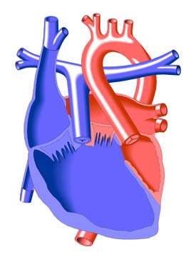Double Inlet Left Ventricle