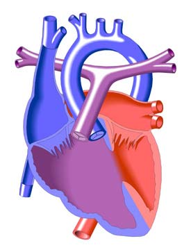 Double Outlet Right Ventricle
