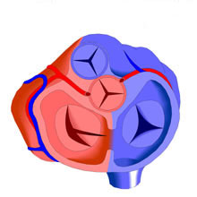 Atrioventricular Canal Partial